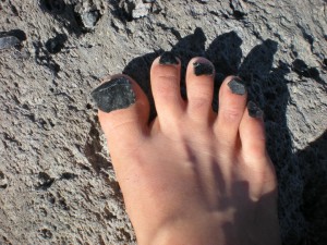 Bare foot with toes covered in obsidian rocks